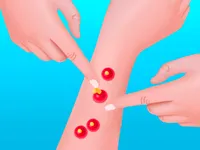 https://arcade-games.site/game/pimple-poper-rush