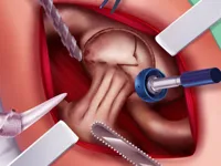 https://arcade-games.site/game/princess-hips-surgery